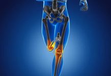 Kemik sağlığı, yaşamın her döneminde korunması gereken temel sağlık unsurlarından biridir. Çocukluk ve ergenlikte kemik gelişimi, yetişkinlikte kemik yoğunluğunun korunması, ileri yaşlarda ise kemik kaybının yavaşlatılması büyük önem taşır. Bu süreçlerin tamamında kemik güçlendirici diyet, iskelet sistemini destekleyen en etkili yaşam tarzı unsurlarından biri olarak öne çıkar. Doğru beslenme alışkanlıkları, kemiklerin dayanıklılığını artırırken kırık ve osteoporoz riskini azaltmaya yardımcı olur. Konulu bir haber görseli.